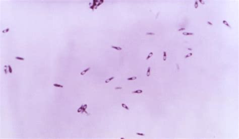 BIOL 230 Lab Manual: Gram Stain of Clostridium perfringens