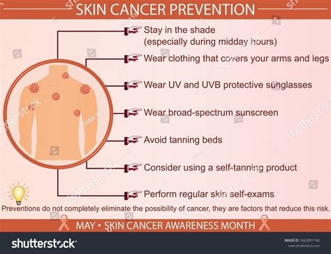 Skin Cancer Disease Prevention Infographic Vector Stock Vector (Royalty ...