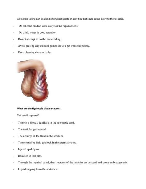 Hydrocele Treatment, Symptoms, Causes, Remedy