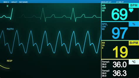 heartbeat monitor screen ecg displays heart Stock Footage Video (100% ...