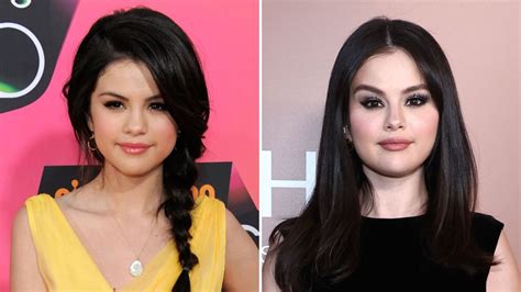 Did Selena Gomez Get Plastic Surgery? Inside Rumors | Life & Style