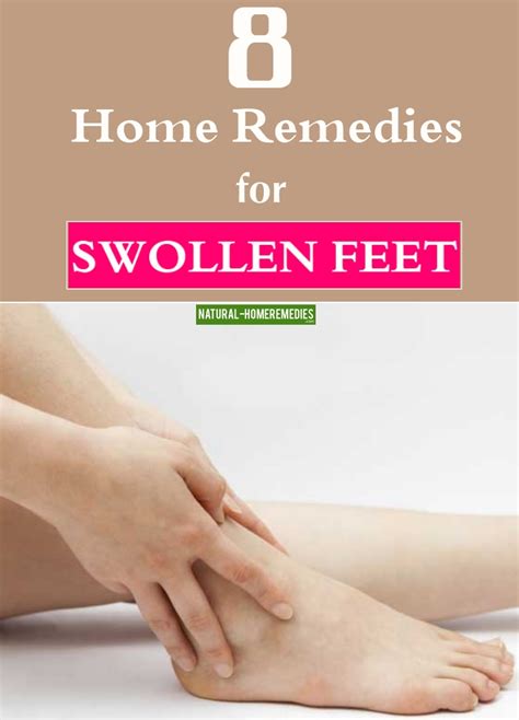 8 Natural Home Remedies For Swollen Feet – Natural Home Remedies ...