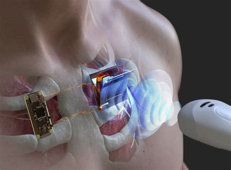 Charging underwater and body-implanted electronic devices using ...