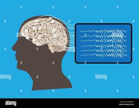 Illustration of human brain and electroencephalography or EEG recording ...