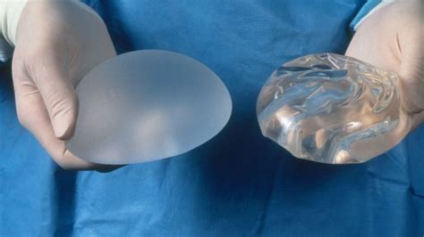 Breast implant register launches 'to safeguard patients' - BBC News