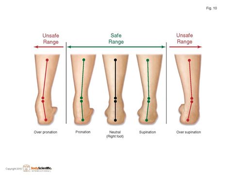 What is foot pronation and Foot supination? Is It Good Or Bad? – Team ...