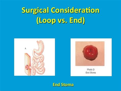 Colostomy complications