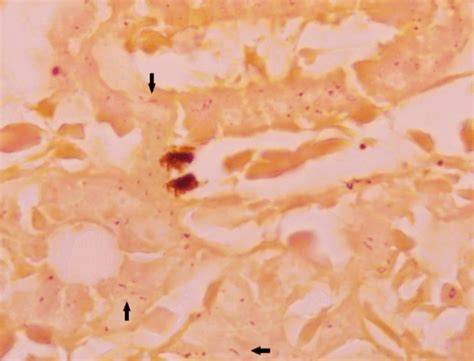 Citrobacter braakii in kidney tissue of rainbow trout, B&B stain ...