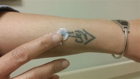 Tattoo Removal Cream: Does It Work? - AuthorityTattoo