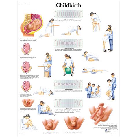 Stages Of Labor Diagram