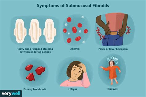 Submucosal Fibroids Symptoms Causes And Treatment – NBKomputer