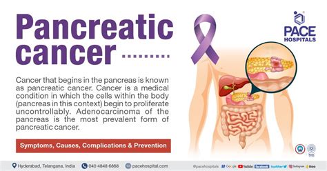 Symptoms Of Pancreatic Cancer