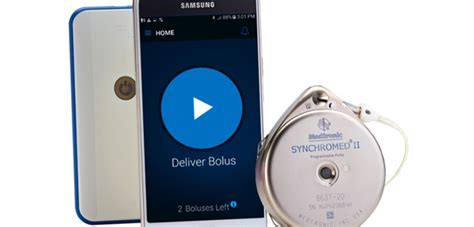 FDA Approves Medtronic Pain Pump App | Orthopedics This Week