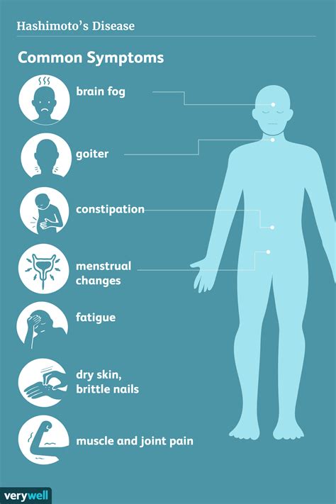 Hashimoto's Symptoms and Complications