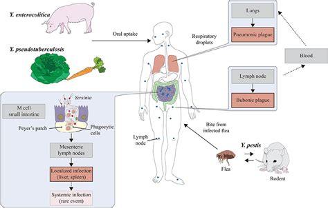 Yersinia Pseudotuberculosis Infections; Pseudotuberculosis, Pasteurella