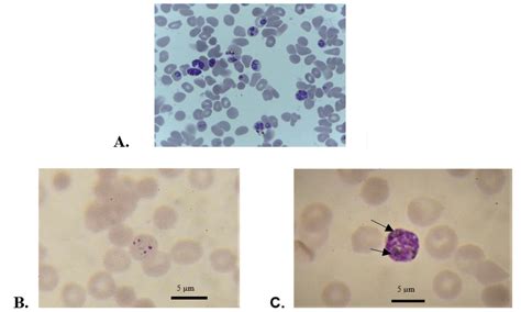 Microscopic images of Plasmodium falciparum from in vitro cultures A ...