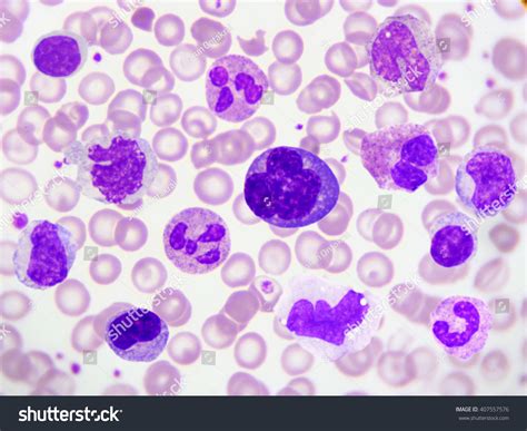 Hematology Society HS Blood Cells In Peripheral Blood Smear, 49% OFF