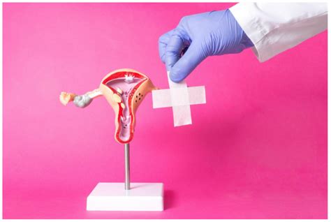 Ovarian Cyst Surgery in Chennai: Purpose, procedure, risks and recovery ...