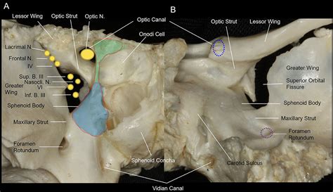 Frontiers | Simultaneous Endoscopic Endonasal Decompression of the ...