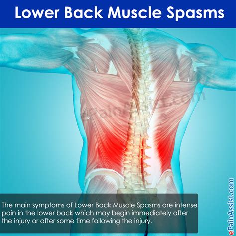 Sakit pinggang... Slip disc atau lower back muscle spasm? | ALIA FARHAN