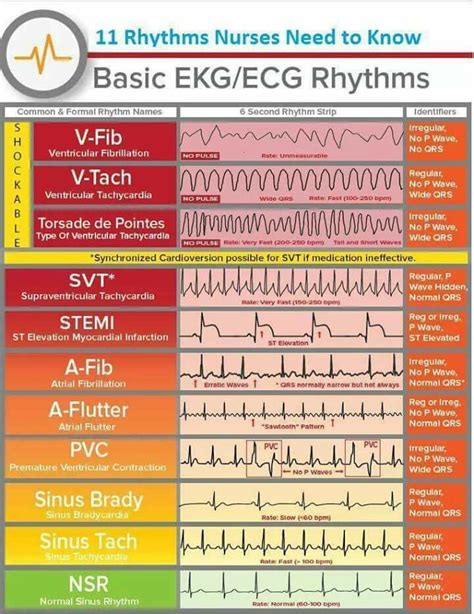 #cardiacfitness | Nursing school survival, Nursing notes, Nurse