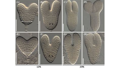 Late stages of jlo-2 embryogenesis. Embryos were isolated from siliques ...