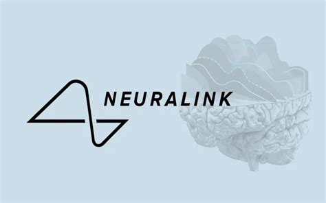 Neuralink Likely To Begin First Human Trial Later This Year: Elon Musk