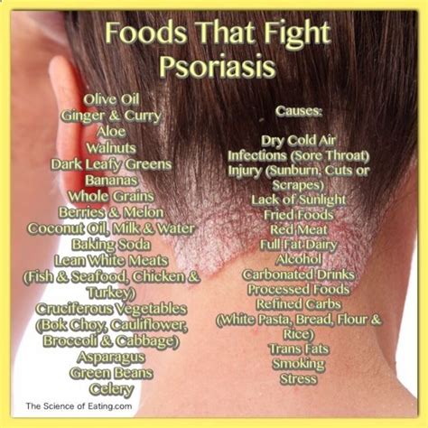 Psoriasis Diet - Foods That Fight Psoriasis 3 REAL PEOPLE. REAL RESULTS ...