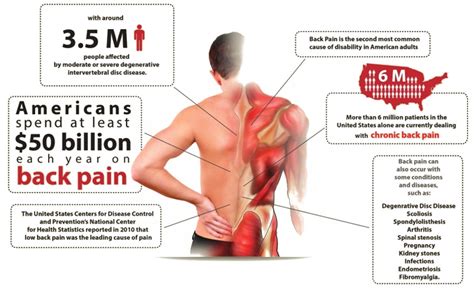 How Chiropractic Care Eases the Most Common Types of Back Pain ...