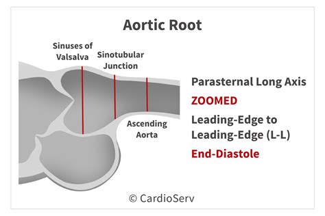 Back to the Basics: Aortic Valve Anatomy