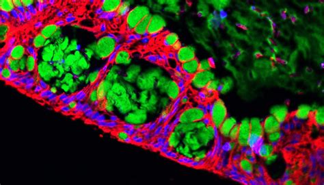 How to Run a Barrier Permeability Assay Using Human Intestinal Organoid ...