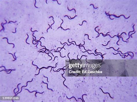 Spirillum Volutans A Large Spiral Bacterium 100x At 35mm Prokaryotic ...