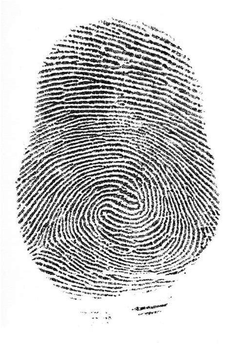 Ulnar Loop Vs Radial Loop Fingerprint