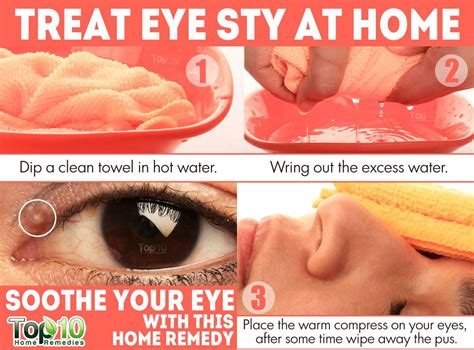 Home Remedies for Eye Sty (Stye) | Top 10 Home Remedies