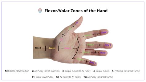 Flexor Tendon Injury Repair (with Images)