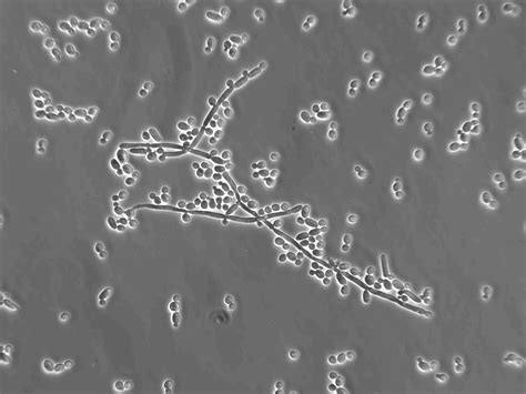 Fungal Diseases