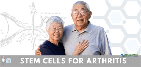 Stem Cell Therapy for Arthritis - Rheumatoid & Osteoarthritis