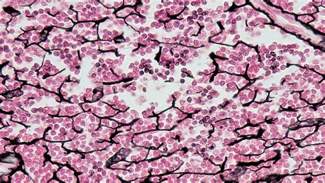 Diagram of Reticular Connective Tissue | Quizlet