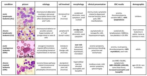 AML-CML-ALL-CLL Comparision | Medical Laboratories