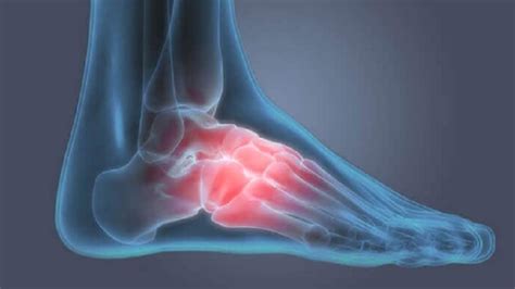 5 Common Foot Injuries And How To Treat Them