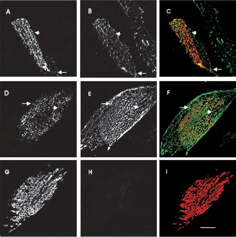 Figure 2 from The vitronectin receptor associates with clathrin-coated ...