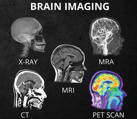 What's the difference between all the different head scans (X-Ray, CT ...