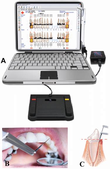 Florida Probe system. | Download Scientific Diagram