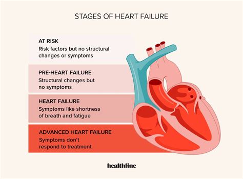 Congestive Heart Failure Stages: Treatment and Outlook