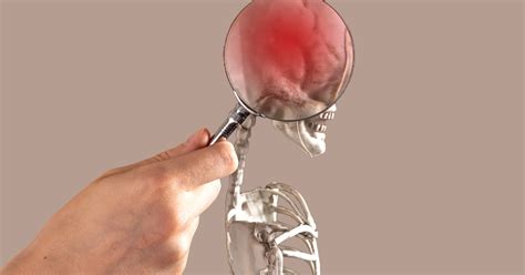 Brain Stem Injury Explained: Causes & Symptoms