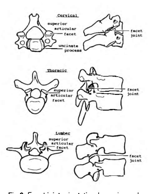 Figure 2 from THE INTERVERTEBRAL JOINTS I I : THE FACET JOINTS ...