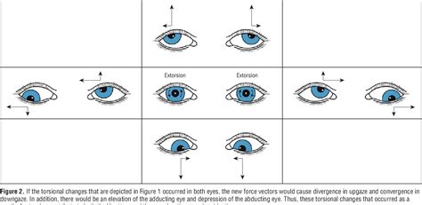 [PDF] Effect of ocular torsion on A and V patterns and apparent oblique ...