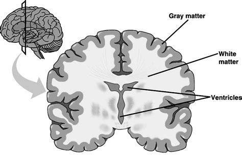 1: A schematic drawing of the human brain, indicating the two main ...