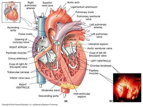 Conus Arteriosus