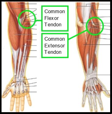 Picture Of Forearm Tendons : Wrist Joint Tendonitis|Causes|Symptoms ...